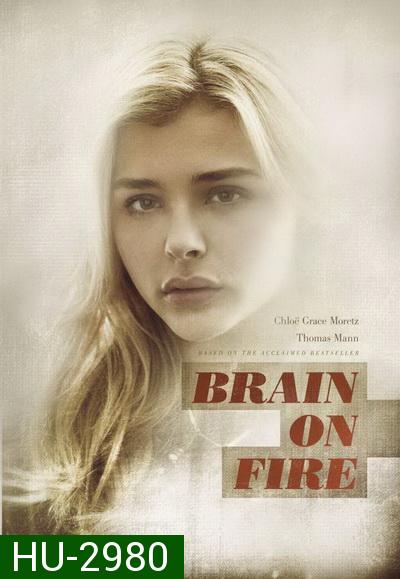 Brain on Fire เผชิญหน้า ท้าปาฏิหาริย์